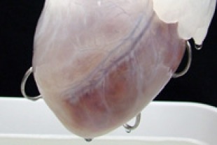 Replacing Body Parts