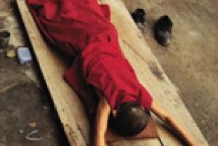 Prostration